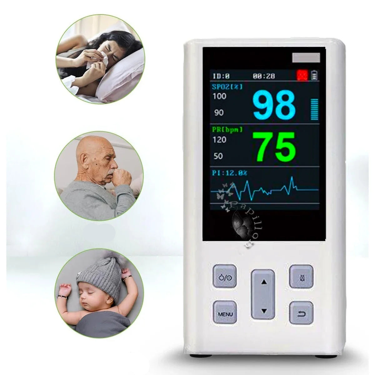 Pet Pulse Oximeter Monitor